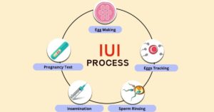 IUI IVF Center in Bopal Clinic